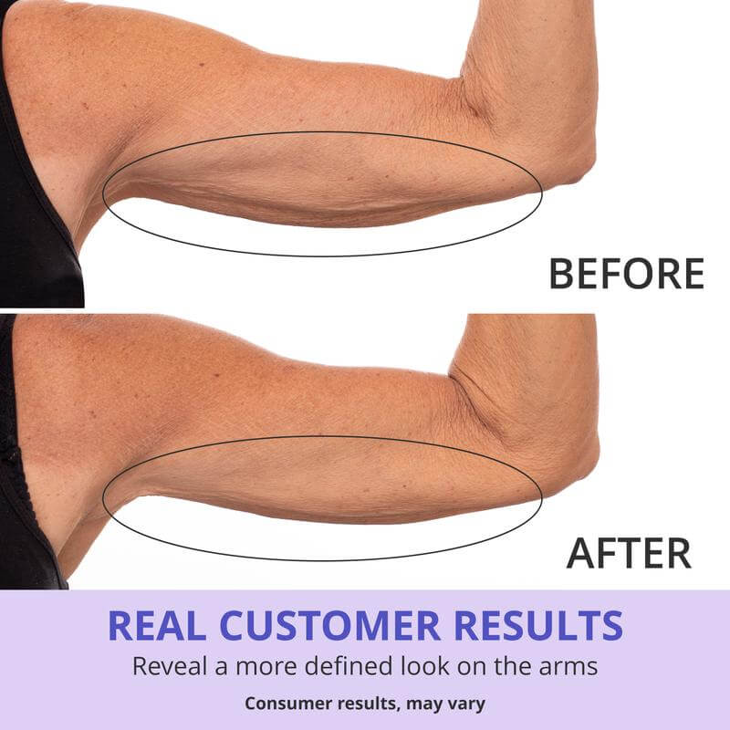 GOPURE Crema para los Brazos - Crema Reafirmante Para la Piel Flácida (Compra 2 y Obtén 1 Gratis)