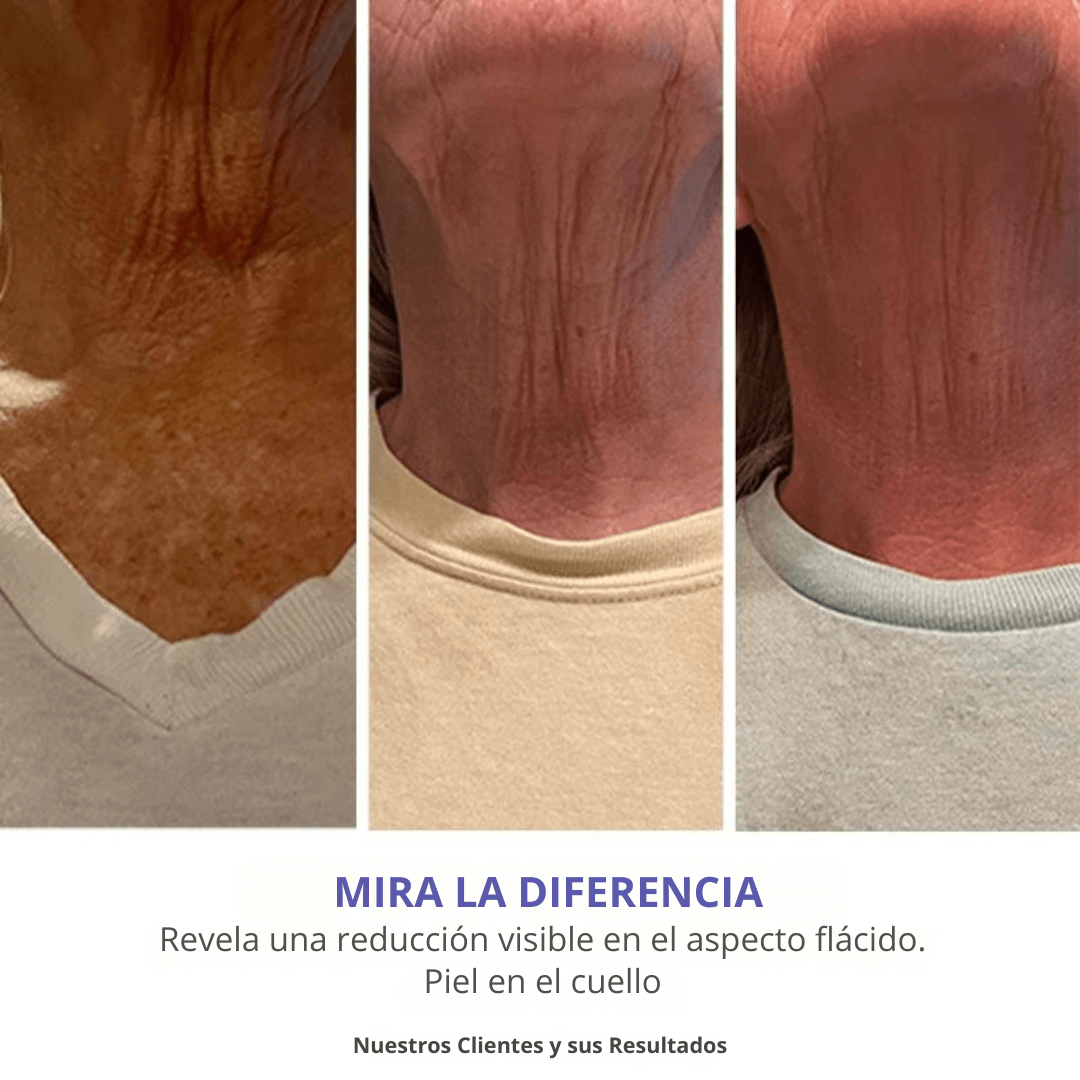 GOPURE Crema para el Cuello - Crema Reafirmante Para la Piel Flácida (Compra 2 y Obtén 1 Gratis)