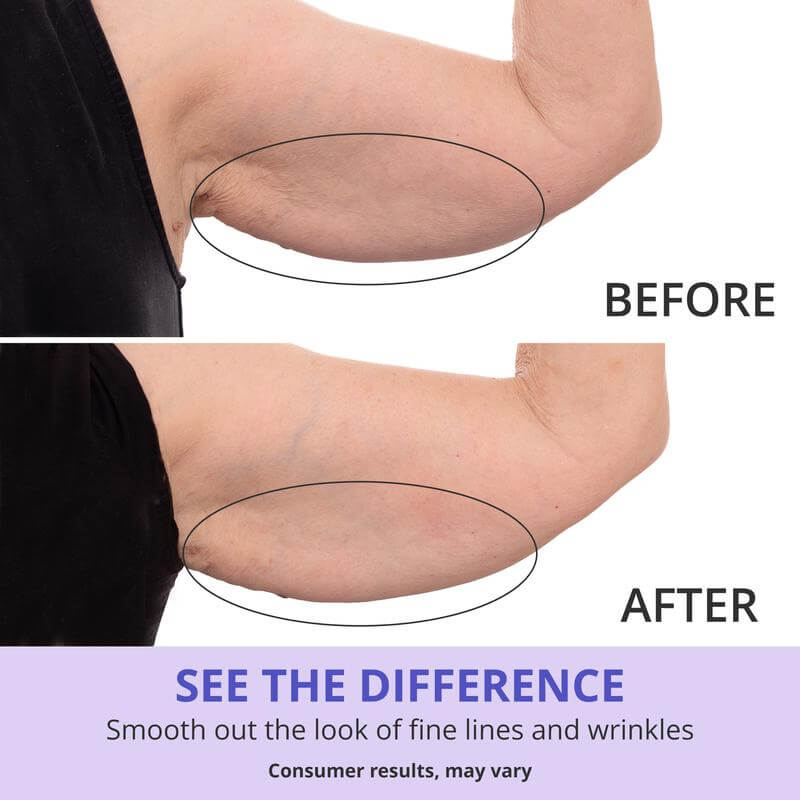 GOPURE Crema para los Brazos - Crema Reafirmante Para la Piel Flácida (Compra 2 y Obtén 1 Gratis)