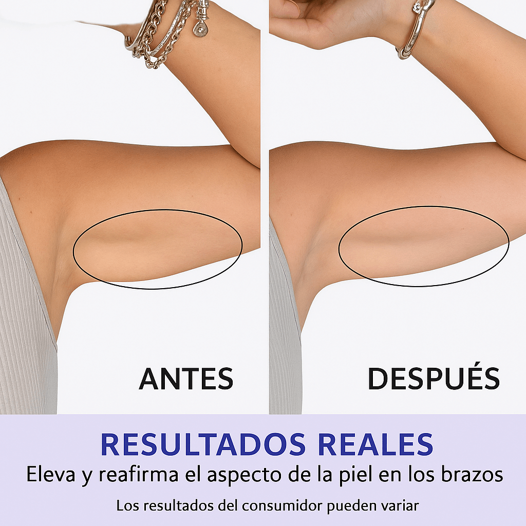 GOPURE Crema para los Brazos - Crema Reafirmante Para la Piel Flácida (Compra 2 y Obtén 1 Gratis)