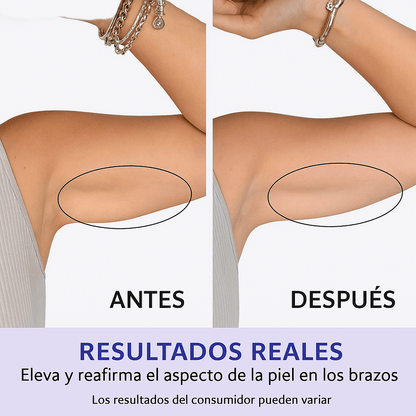GOPURE Crema para los Brazos - Crema Reafirmante Para la Piel Flácida (Compra 2 y Obtén 1 Gratis)